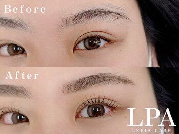 レピア 盛岡店/韓国式LEPIA Before&Aｆter