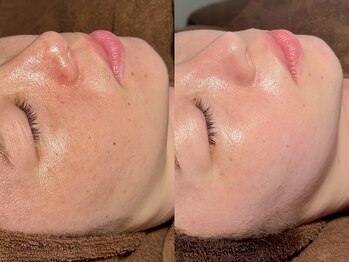 ルーナジェーナ(Luna llena)/池袋　エステ　ルーナジェーナ