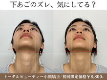 ナチュラルビューティーフェイス 横浜(NBF)