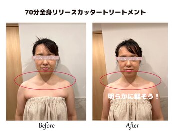 リノ(Lino)/全身リリースカッター