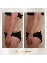 リム ビューティー(RYM BEAUTY)/最新超音波