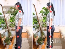 整体サロン イチ(ICHI)/姿勢改善★before/after[目黒]