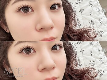 アペル(APPEL)