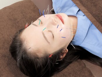 ハリケア 麻布十番院(HARICARE)/美容鍼で艶肌ケア