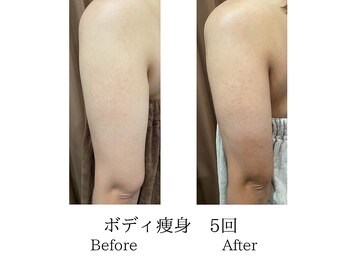 ミーシェ(Meshie)/-2センチ！