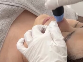 シルキーエービューティー(Silky A Beauty)の写真/【垢抜け美人は素肌で決まる☆】毛穴の開き＆黒ずみを撃退！ララピールとの同時施術で艶＆美白にも◎
