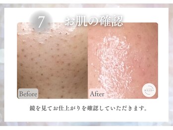 モアナ(MOANA)/毛穴レス&韓国肌管理