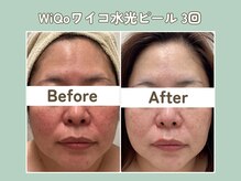 プティ カシェット 伊丹店(petit cachette)/ワイコwiqoビフォー・アフター1