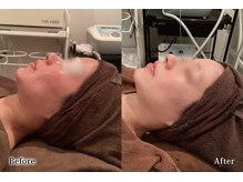 アネル 浦添店(anel)/