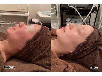 アネル 浦添店(anel)/