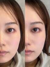 グロウ(Grow)/まつ毛パーマ【まつ毛/眉毛】