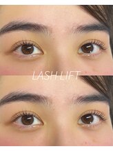 ウィロー(WILLOW)/LASHLIFT