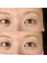 エニーアイラッシュ 高砂店(ANY Eyelash)/lashlift