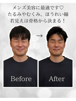 シナジェ 並木通り店(Synergye)/初回から変化します♪