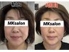 【5月限定☆むくみ・たるみ即効ケア】小顔矯正+ドライヘッドマッサージ 60分 