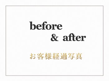 エモーション 自由が丘店(Emotion)/before→after☆自由が丘痩身