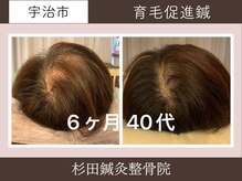 杉田鍼灸整骨院の雰囲気（鍼で頭皮環境改善。専用剤等で変わらなかった方のご来院多数。）
