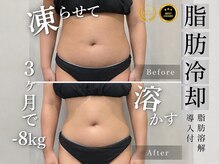 サロン ド パーフェクション(Salon de Perfection)