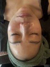 エワル 半田店(ewalu)/REVIハーブピーリング【2】