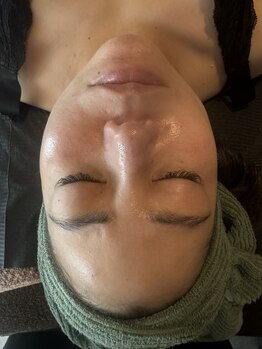 エワル 半田店(ewalu)/REVIハーブピーリング【2】