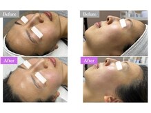 ホワイトワックス 新宿店(WHITE WAX)/☆BeforeAfter☆