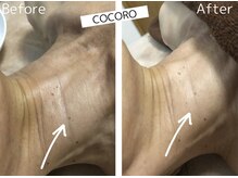 ココロ(COCORO)/お首のおシワ改善にも◎