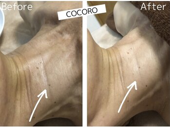 ココロ(COCORO)/お首のおシワ改善にも◎