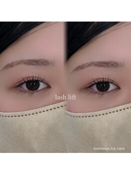 ホワイトアイ 福岡天神(WHITE EYE)/【福岡天神】ラッシュリフト