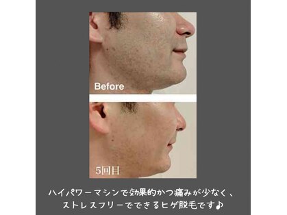イズム(ism)の写真