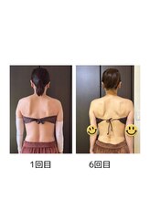 サロン ビールーム(salon 美-room)/肩甲骨