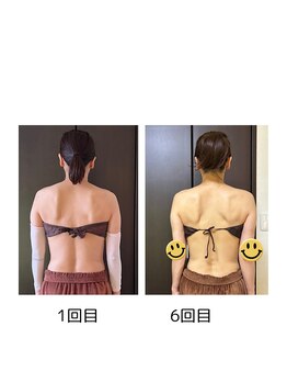 サロン ビールーム(salon 美-room)/肩甲骨