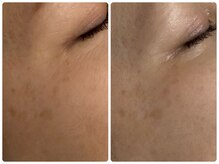 シェミー(CHEZ MEE)/シミしわ究極ケア*乾燥*保湿*潤