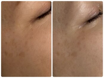 シェミー(CHEZ MEE)/シミしわ究極ケア*乾燥*保湿*潤