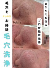 ソワン ドゥ シャルマン(soin de charmant)/衝撃走る！こんなに詰まってたの