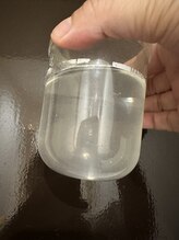 アイムエステ 横浜店(i'm este)/毛穴洗浄後の汚れがごっそり