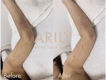 アリリィ(ARILY)/ARILY after care salon