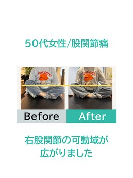 ファースト(FIRST)/股関節の可動域が広がった!