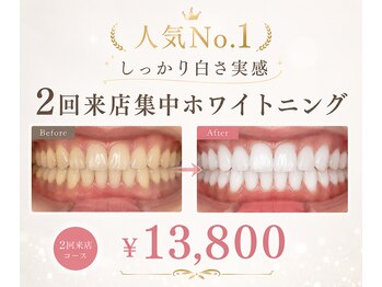 グリッター ショウナン(glitter. SHONAN)の写真/本気で歯を白くしたい方限定】2回来店集中ホワイトニング/藤沢ホワイトニング/ホワイトニング藤沢