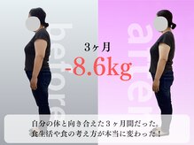 みくる整骨院 美容整体  清須/ダイエット/痩身/肩こり/整体