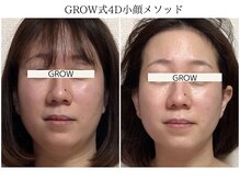 グロウ バイ フェイシャルデザイン アンド アイ(GROW)/