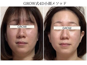 グロウ バイ フェイシャルデザイン アンド アイ(GROW)/