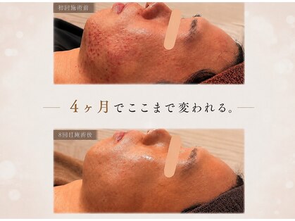 アンリミット 代々木上原店(Une limit)の写真