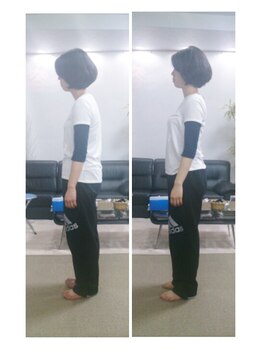 ウルオス/猫背改善も一度でここまで◎