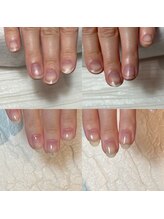 キュア(Cure.)/爪の形が変わる自爪育成の施術