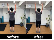 アオ整体院/肩こりお客様☆ビフォーアフター