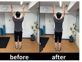 アオ整体院/肩こりお客様☆ビフォーアフター
