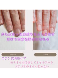 広がったお爪も幅寄せ