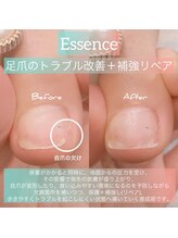 エッセンス (Essence)/食い込み予防,改善ケア＋リペア