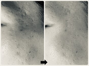 エフェクト 塚口店(effect)/Before After 40代/7回目