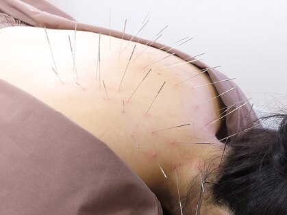 せせらぎ鍼灸院の写真